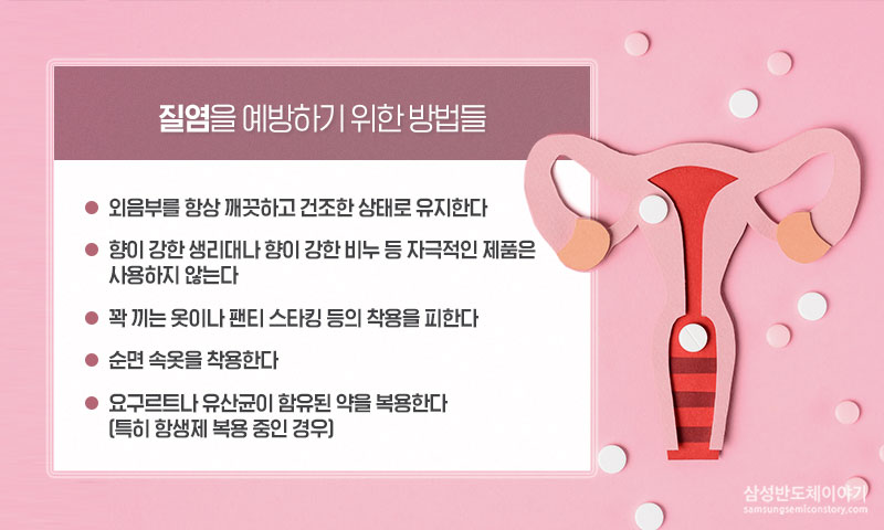 질염