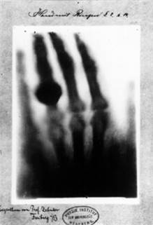 ▲ <인류 최초의 X-선 사진, Wilhelm Conrad Roentgen>, 1895.12.22.